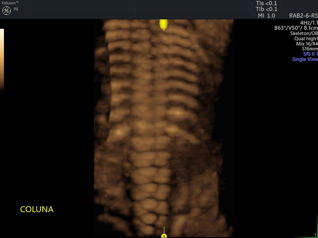Ultrassom Dr. Raphael Izidoro Tianguá